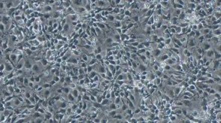 如何从多能干细胞生成神经祖细胞？