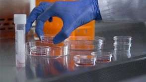 How to Harvest Cells from CFU Assays