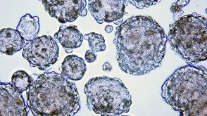Enumerating Mammospheres and Tumorspheres from Cells Cultured in MammoCult&trade; Medium