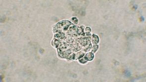 NeuroCult&trade; Neural Colony-Forming Cell (NCFC) Assay