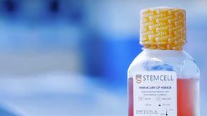 Procedure for Setting Up the CFC Assay