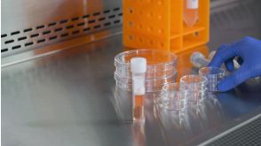 CFU Assay Setup for Custom Hematopoietic Training Courses