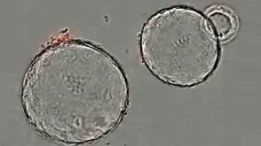 Growth of Pancreatic Organoids in PancreaCult™