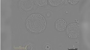 Growth of Liver Organoids in HepatiCult™