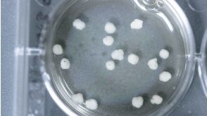 How to Grow Cerebral Organoids