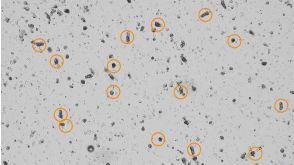 Counting Intestinal Crypts for Organoid Cultures