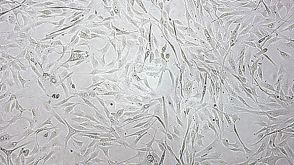 Characterization of MSCs Cultured in Xeno-Free MesenCult™-XF