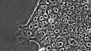 A Step Closer to Clinically-Compatible Culture of hESCs and hiPSCs with TeSR&trade;2