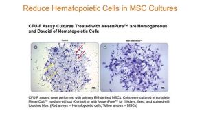 Tips & Techniques for Highly Enriched Mouse MSC Cultures As Early As Passage 0