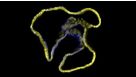 Drug Screening with Human Pancreatic Organoid Cultures