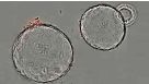 Growth of Pancreatic Organoids in PancreaCult™