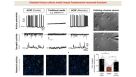 The Road to Functional Human Neuronal Circuits in Vitro
