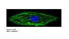 Modeling Arrhythmias Using hPSC-Derived Cardiomyocytes and Tracking Their Excitability