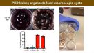 Re-Creating Disease with Kidney Organoids and CRISPR